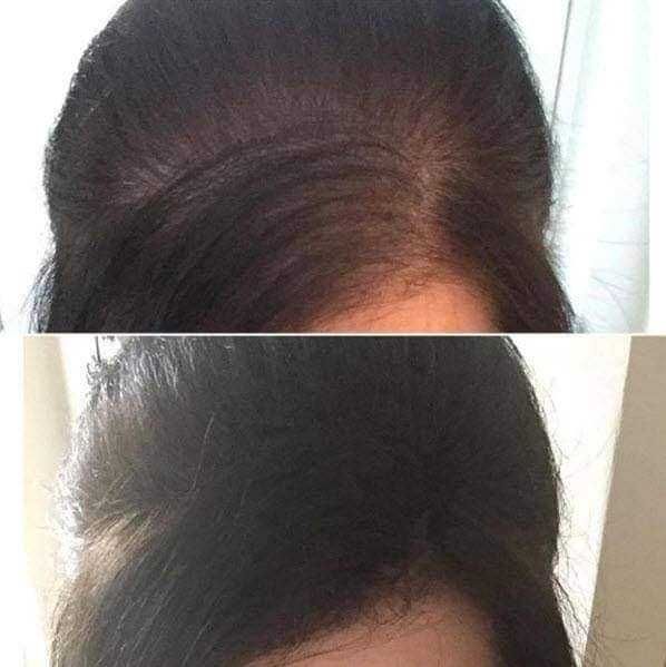 Фибри за коса Toppik за плешивина | ХИТ ЦЕНА | 11 евро