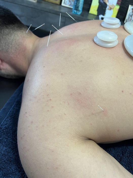 KinetMed -Kinetoterapie,masaj,acupunctura etc la cabinet sau domiciliu