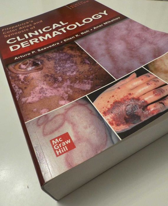 Fitzpatrick's Color Atlas and Synopsis of Clinical Dermatology NOU !