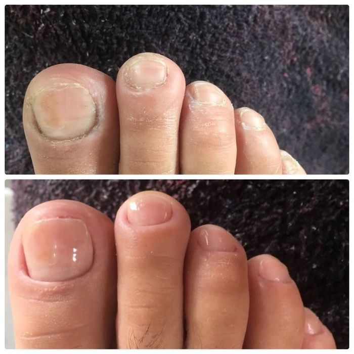 Педикюр маникюр титановая нить