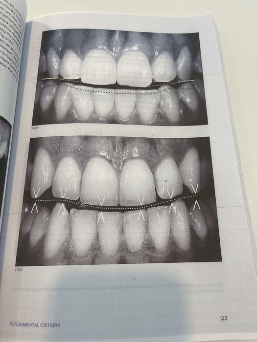 Biomimetic Restorative Dentistry  Volume 1 Pascal Magne Urs Belser
