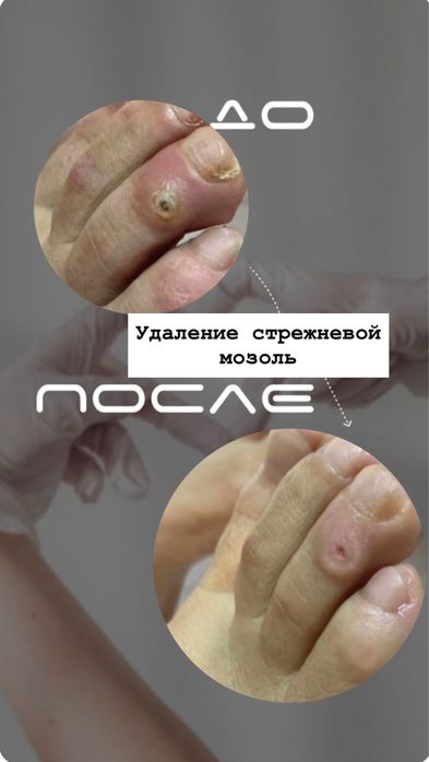 Мастер педикюра-подолог