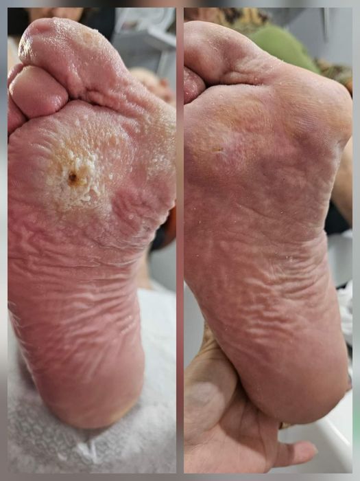 Pedichiură clasică și medicală