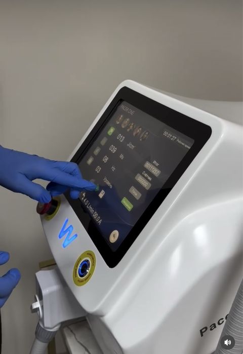 Лазерный Аппарат Pacer One