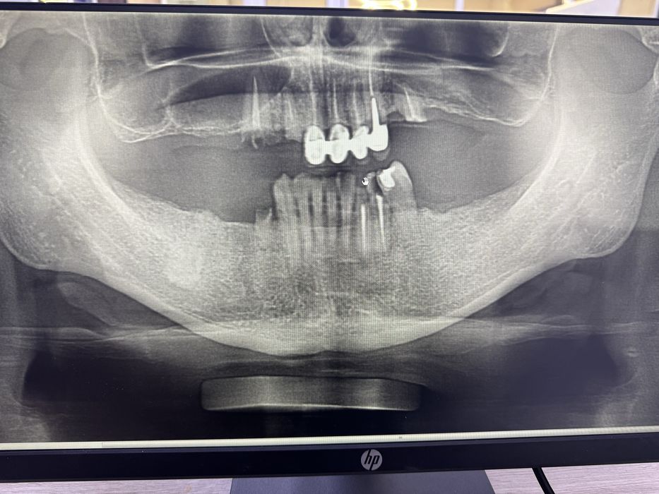 3D рентген апаррат