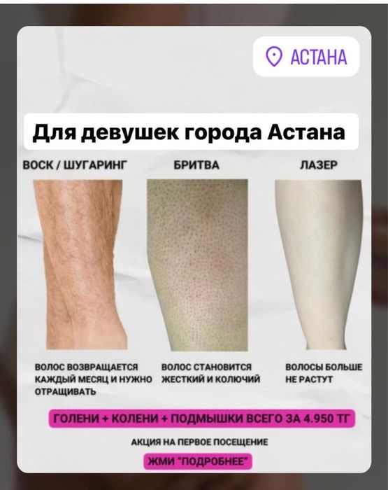 Лезерная эпиляцыя по доступным ценам, на аппарате Soprano Titanium.