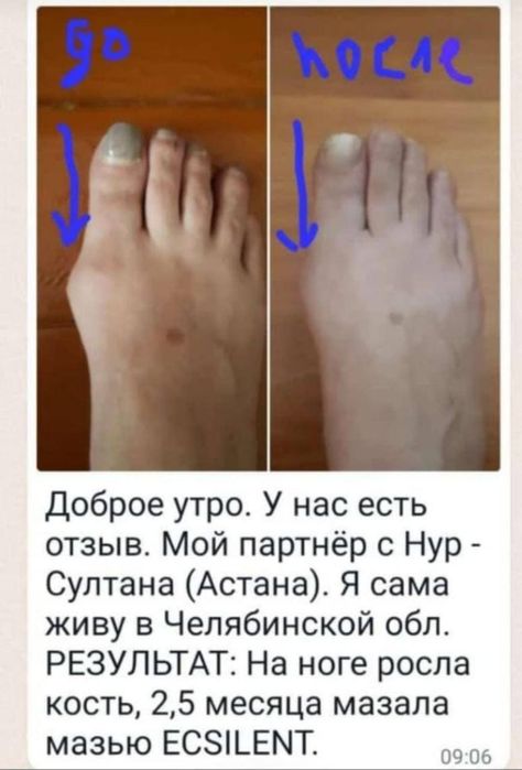 Бальзамы Короткова