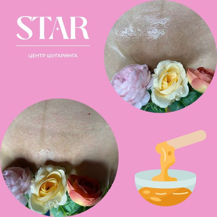 Услуга шугаринг/эпиляция качественно