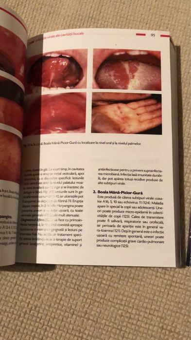 Medicina si Patologie Orala-TOVARU-VOL I / EDITIA A - II - A 2012