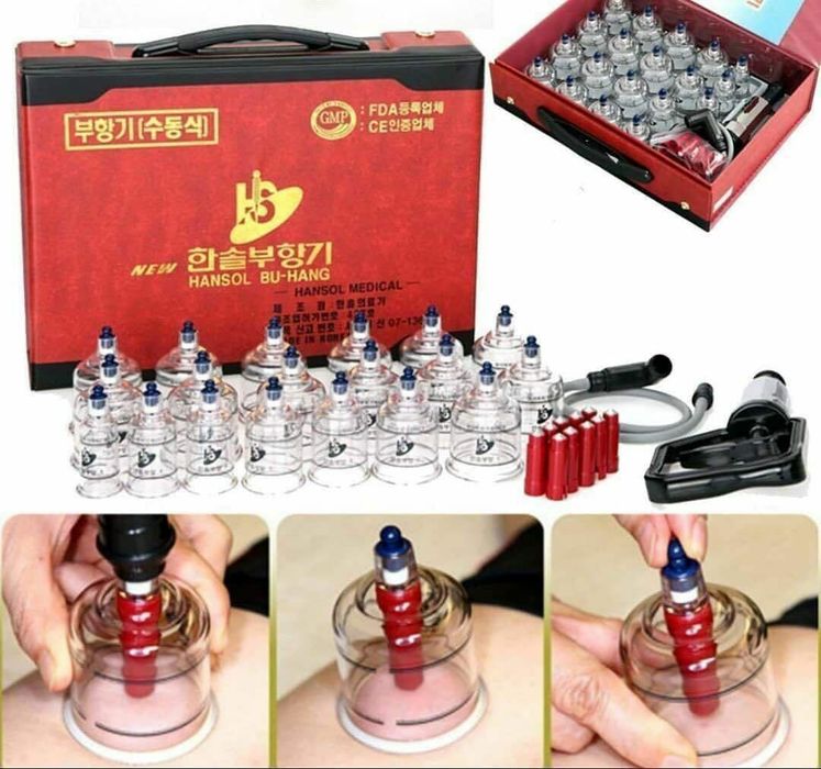 Оригинальные корейские вакуумные банки для хиджамы и массажа