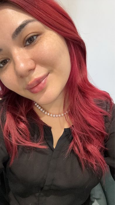 Увеличение губ | Ташкент | Натуральный результат