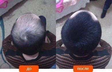 Средство для маскировки залысин