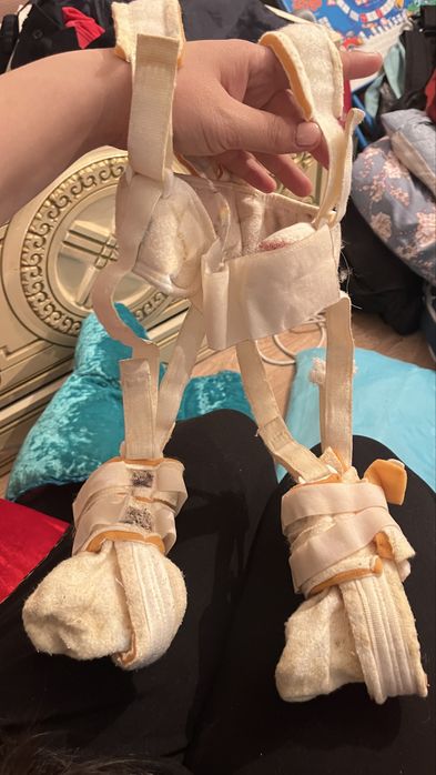 Бандаж детсий дисплазияға