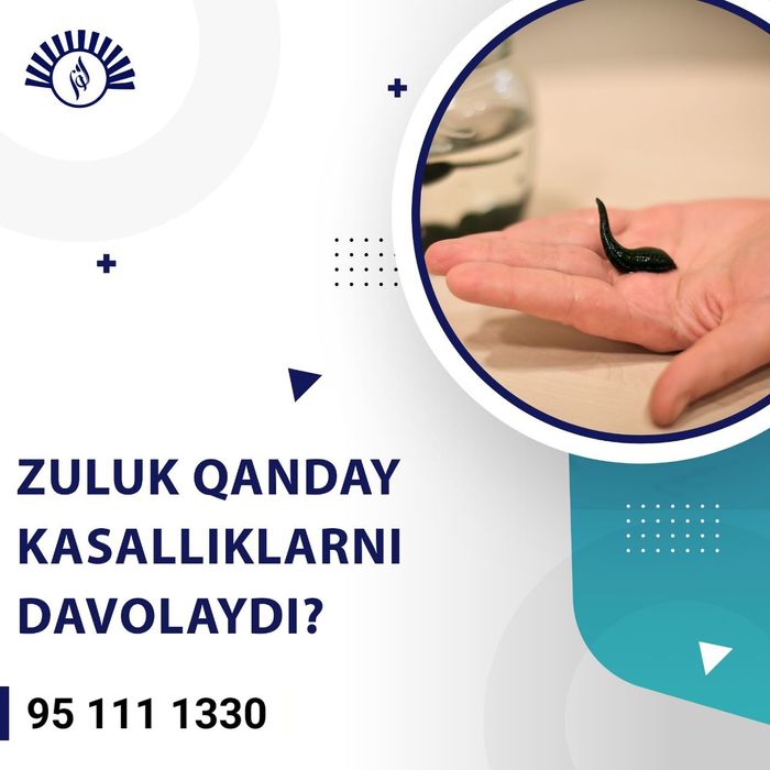 Xijoma va zukuk va hijoma хиджама