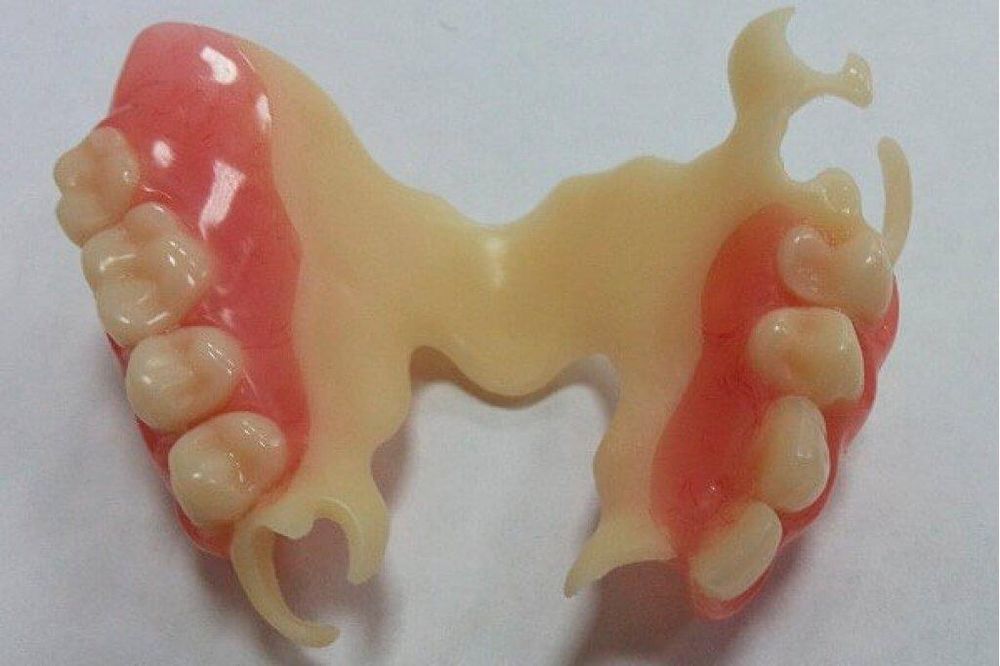 Сьемные Протезирование