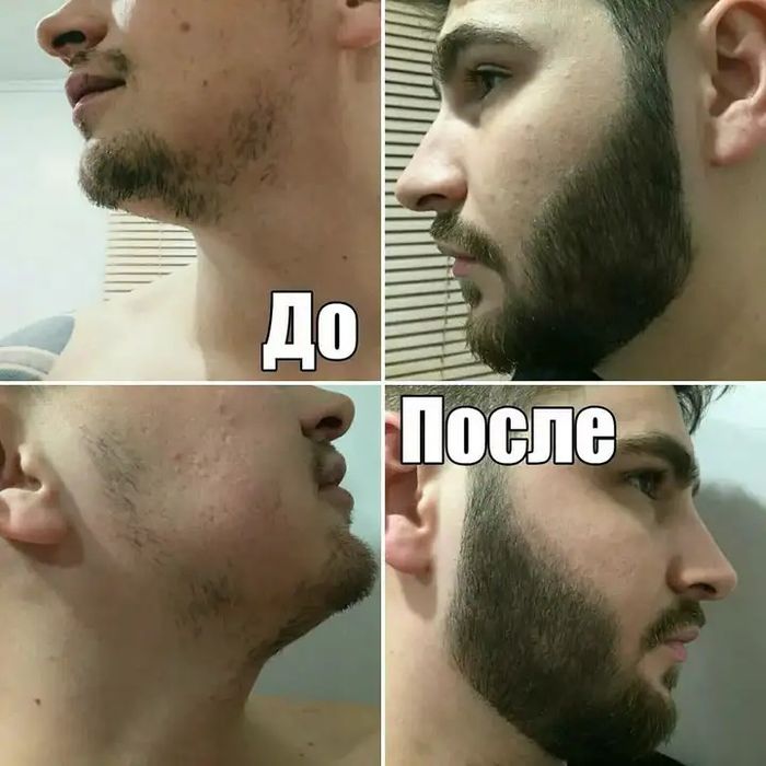 Соч ва сокол Устирмокчими СИЗ Унда СИЗ тугри жойда 100% кафолатли