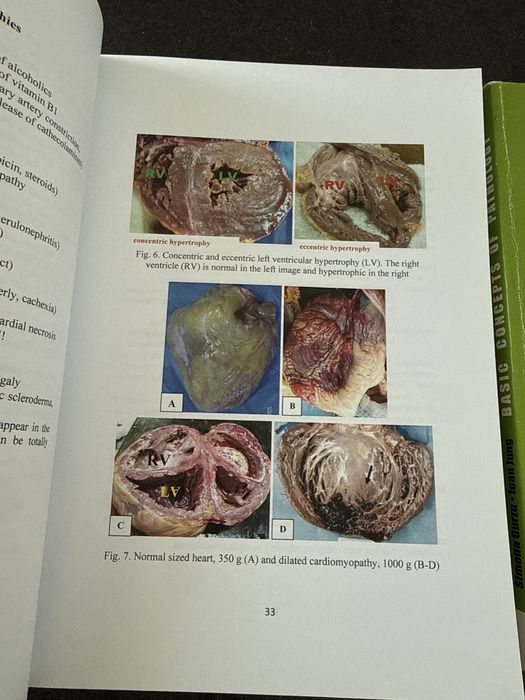 2 carti Pathology in engleza