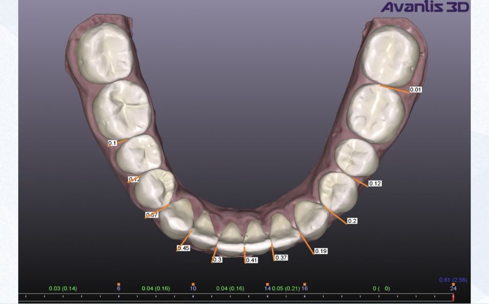 3Shape программа для импланталогии