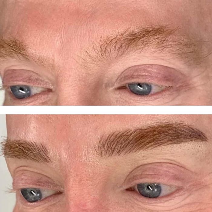 Micropigmentare scalp barba efect indesire par