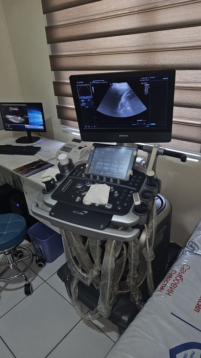 УЗИ(UZI) аппарат ALPINION E-CUB 15 EX сотилади