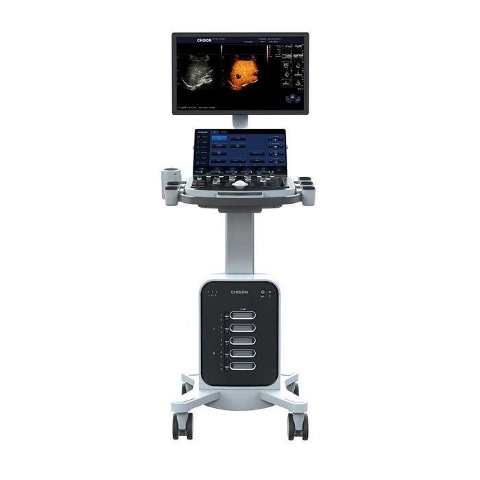 УЗИ аппарат Chison SonoMax, новый