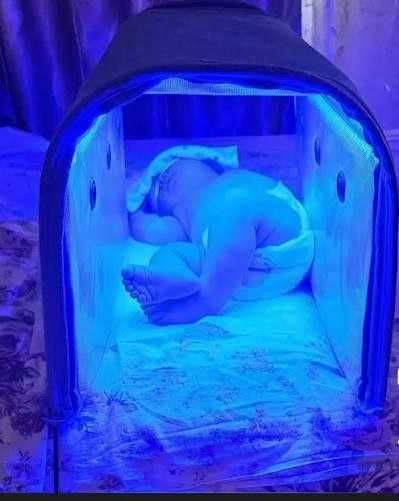 фотолампа от желтухи Ташкент