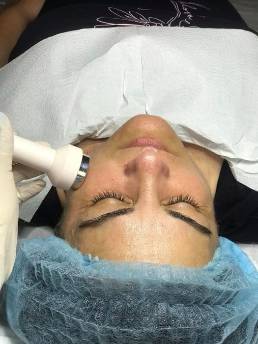 Cosmetica-Tratamente Faciale-Curatare-Epilare cu ceara