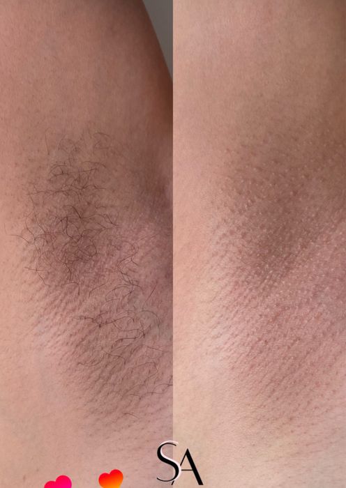 Мастер депиляции с выездом