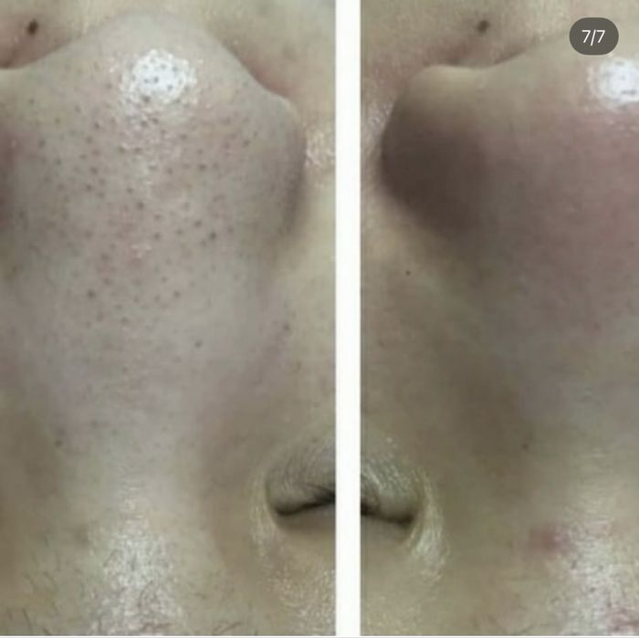 Шугаринг,косметология ,массаж