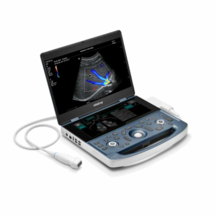 УЗИ аппарат Mindray MX-7