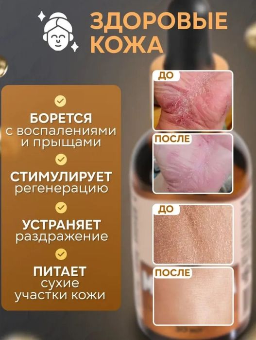 Масло Монарда+Чайное дерево.