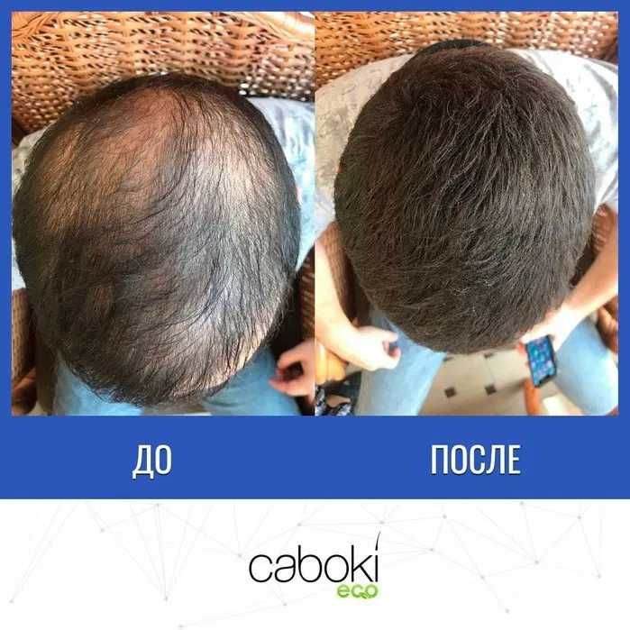 Сочни қалинлаштирувчи Caboki 25 g. | Доставка бепул