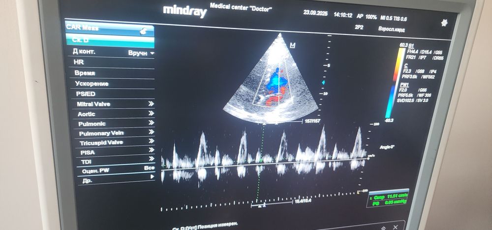 Миндрай дс7 узи аппарат