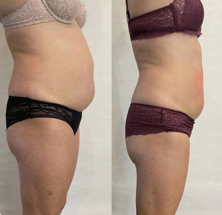 Массаж оздоровительный