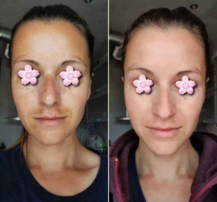 Крем за лице против бръчки и пигментни петна