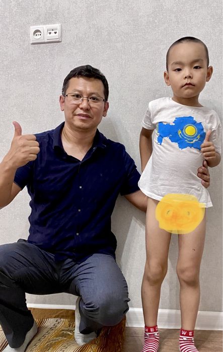 Обрезание Сүндеттеу  профессионально