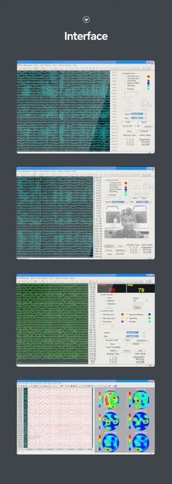 ЭЭГ 32-канальная цифровая ЭЭГ и картографическая система!