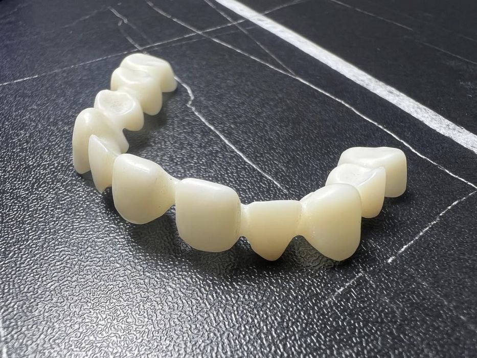 Цирконий / E-max за 2–3 дня | Luminora Dental
