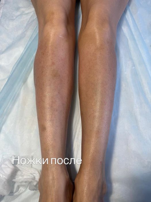 Шугаринг на дому