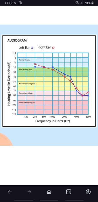 Стар Докторски Уред за мерене на слуха