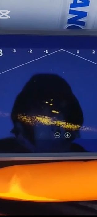 Продам датчик Lowrance Active target 1
Прибор и датчик