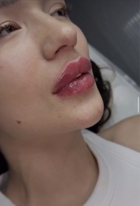 Аугмен губ 23900