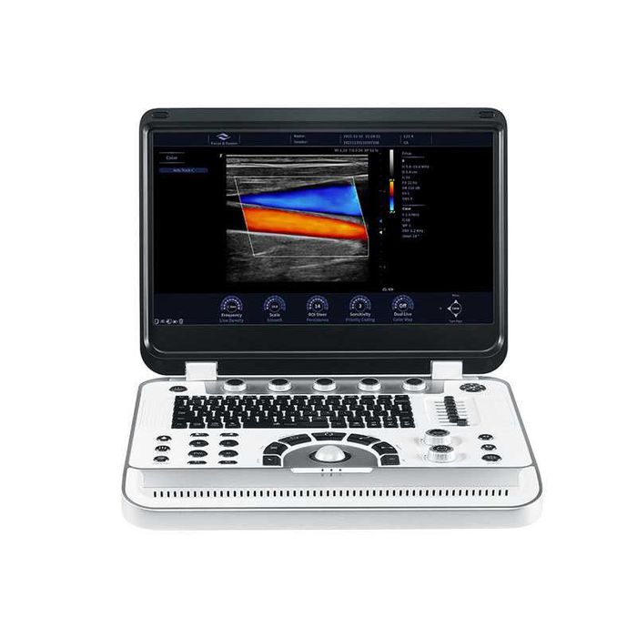 Finus 70 – портативный диагностический ультразвуковой аппарат