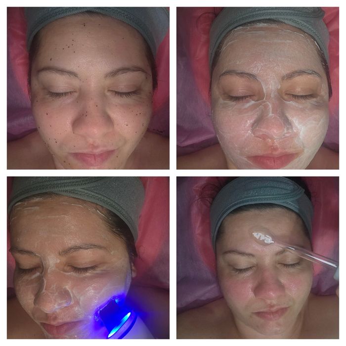 Tratament facial de curățare