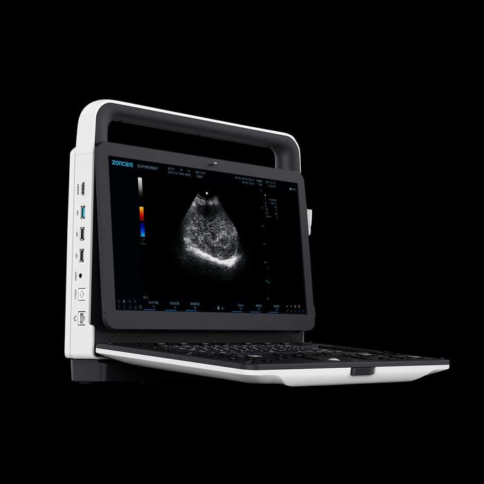 Рассрочка УЗИ аппарат, Доплер, Скрининг  в Ташкенте.