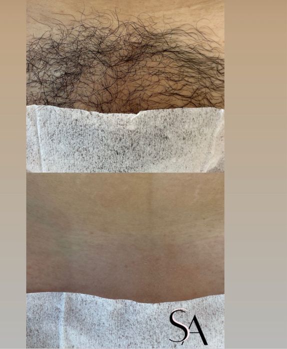 Мастер депиляции с выездом