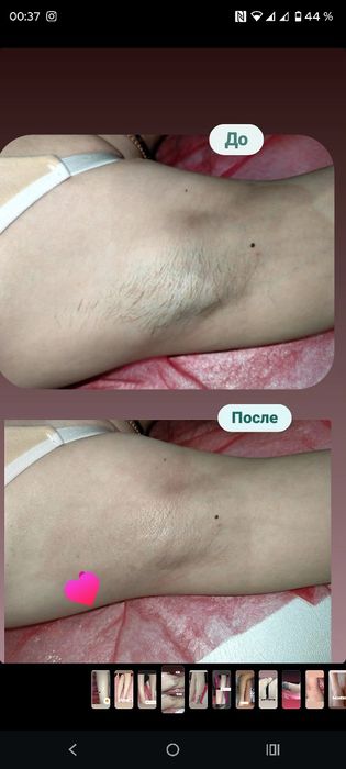 Шугаринг воском западный