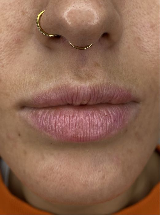 Пирсинг и прокол ушей