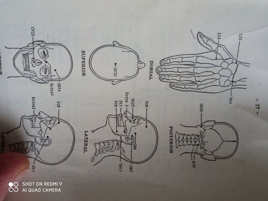 Нейростимулатор Энс