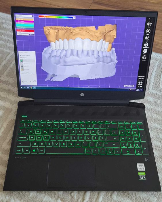 Vand Laptop HP ,cu Exocad 2.3 Matera
